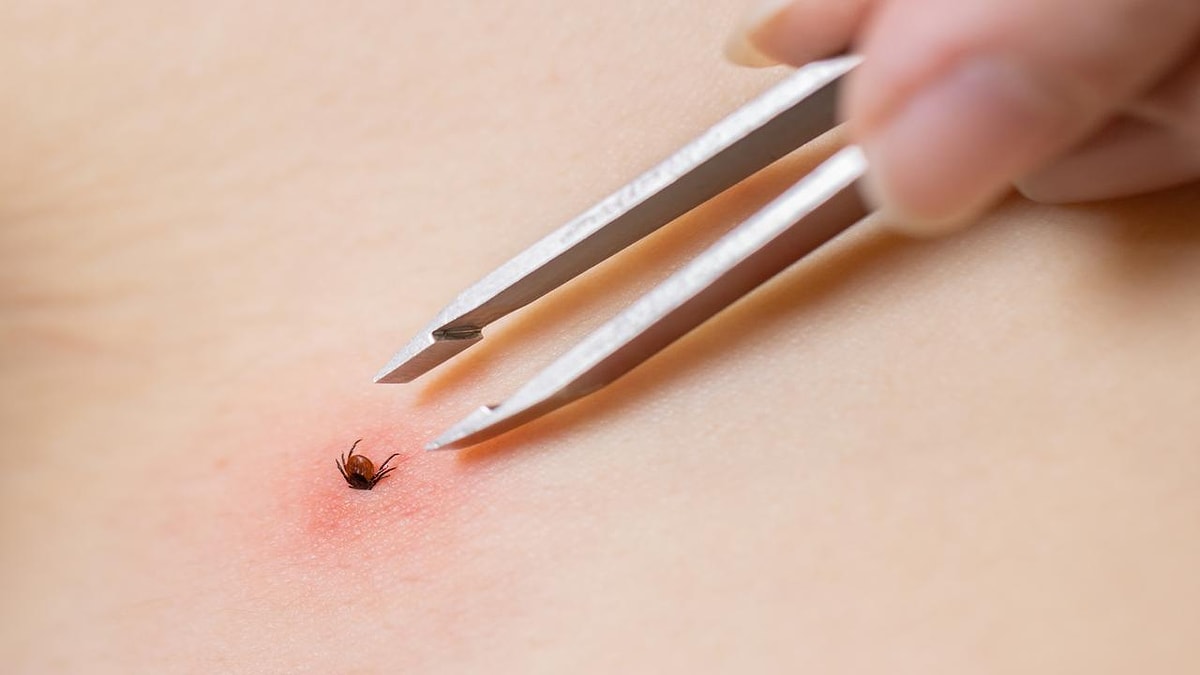 Sivas'taki acı kaybın ardından kene vakaları yeniden gündemde. KKKA, Lyme